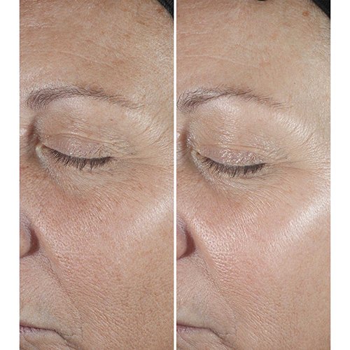 CLINIQUE-Smart Clinical Repair Serum - Anti-Wrinkle Correcting CLINIQUE-Smart Clinical Repair Serum - Anti-Wrinkle Correcting